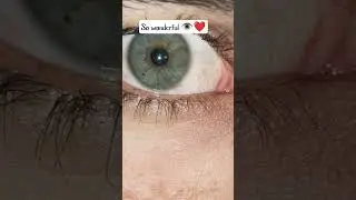 @visioneyelasercenter#eyes #india#shortvideo #wanderfull #opthalmology #uttarpradesh #lovely 👁️