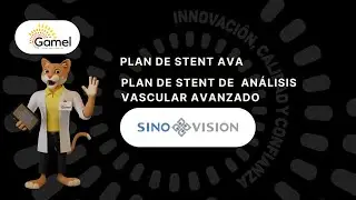 SINOVISION WORKSTATION  -  AVA STENT PLAN