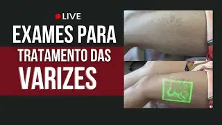 Pra que serve os exames para o tratamento de Varizes?