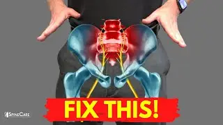 How to Get Rid of Sciatica Pain AT HOME