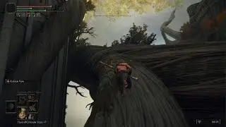skill skissue