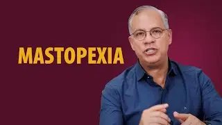 Respondendo as maiores D&Uacute;VIDAS SOBRE MASTOPEXIA | Dr Carlos Fernando Neves
