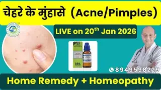 Pimples Treatment in Homeopathy 🩺 पिंपल्स को जड़ से खत्म करने का तरीका | Dr. Dinesh Sharma