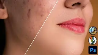 Professional Photo Retouching in the easiest way | Skin Retouching Photoshop Tutorial Bangla | Fa...