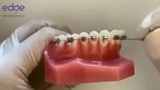 How To Manage A Broken Power Chain (Stretchy Chain)