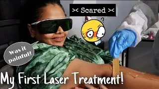 MY FIRST LASER HAIR REDUCTION TREATMENT 🥵