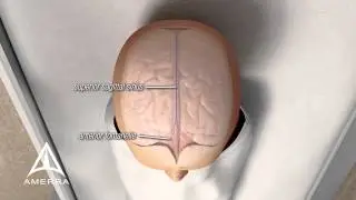 Noninvasix - Safe, Accurate, Noninvasive Fetal Monitoring - 3D Medical Animation