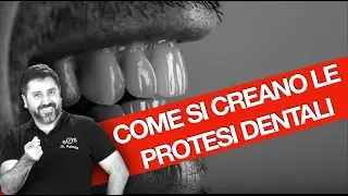 Denti fissi su impianti: Come si creano le linee dentali