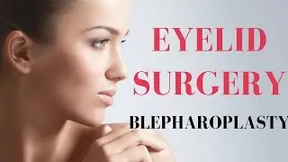 Eyelid Surgery Toronto | Edelstein Cosmetic