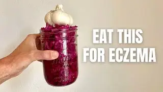 The Best Sauerkraut Recipe for Skin Health | Heal Eczema with Fermented Foods