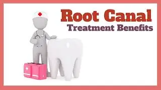 Root Canal Treatment Benefits