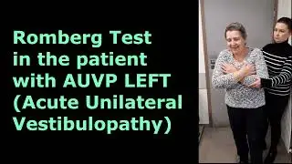 Romberg Test Explained| Acute Unilateral Vestibulopathy Left Side Case Study| Dr. Krystof