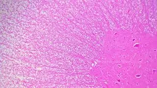 Spinal cord cell TS microscopic sample 100x magnification tinted pink