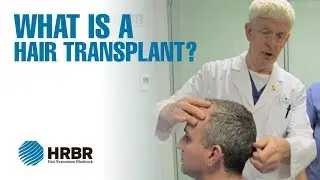 What is a hair transplant? - Hair Restoration Blackrock