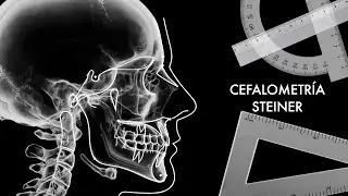 Cefalometr&iacute;a de Steiner