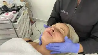 Aula sobre associação com finalização de procedimento com ácido hialurônico em pó!