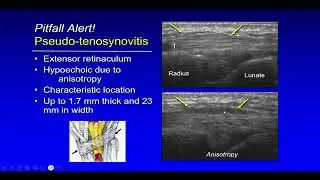 Ultrasound Evaluation of Hand and Wrist Pathology-SAMPLE