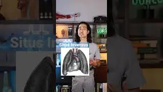 Сердце справа или слева? Объясняет врач #situsinversus #врач #анатомия