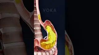 Что происходит в твоем теле, когда у тебя рвота? 🤢 Объяснение в 3D