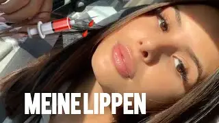 VLOGMAS #13 Alles über meine LIPPEN