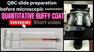 QBC slide preparation before microscopic examination | @medicallabtechnologysajal6903