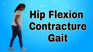 Hip Flexion Contracture Gait