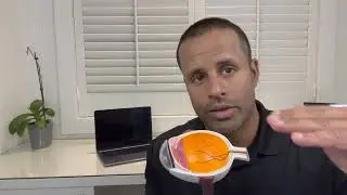 ICL   Implantable Collamer Lens   Phakic IOL