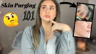 SKIN PURGING 101//MY EXPERIENCE AND EVERYTHING YOU NEED TO KNOW!!//Sophie Charlson