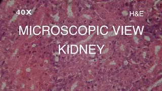 MICROSCOPIC VIEW- KIDNEY