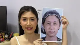 ตกใจ 43 ปี ใครเห็นก็ว่า 20 ไม่เชื่อก็ต้องเชื่อ หลังทำเฟซล็อคและตาสองชั้น ￼ธีรพรคลินิก หมอชลธิศ