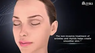 Illumia Medical - 5G Thermage FLX