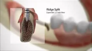 Thor Animated Ridge Split Video