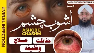 Ashob e Chashm Ka Ilaj , Hifazat Aur Khas Wazifa | Eye Infections Treatment | Conjunctivitis Cases