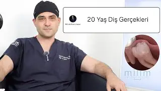 Çene Cerrahı 20 Yaş Diş Sorularını Cevaplıyor