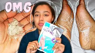 I TRIED THE FOOT PEELING MASK *SHOCKING RESULTS*
