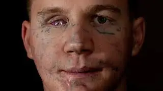 Kyle Carpenter, The brave Marine and the youngest living medal of Honor recepient