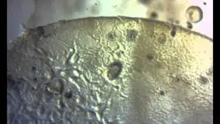 'Bagging' Process in C. elegans