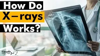 How Do X-rays Works? | X-rays types (Urdu/Hindi)