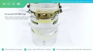 Cement-Augmented Pedicle Screw System & TLIF PEEK Cage | Osteoporotic Spine Solution