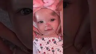 ASMR Facial on Baby Ellie
