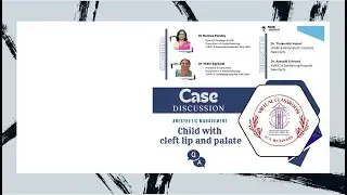 Child with cleft lip and palate: ICA Webinar 217