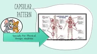 CAPSULAR PATTERN | BRIEFLY | FROZEN SHOULDER EXAMPLE  | URDU/HINDI | IMPORTANT TOPIC