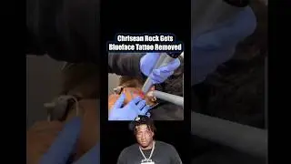 Chrisean Rock usuwa tatuaż z niebieską twarzą