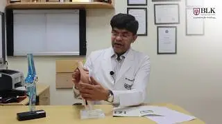 Dr. Ishwar Bohra talks about Knee Pain &ndash; Its treatment, causes & pain relief.