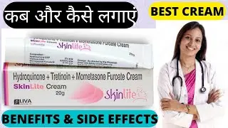 Skinlite cream review, uses, side effects, fairness cream , लगाने का सही तरीका , हिंदी।