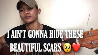 Beautiful Scars - Jong Madaliday