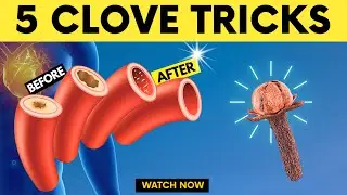 5 Clove Tricks That Help Unclog Arteries and Control High Blood Pressure