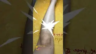🌸 Laser Diode lạnh s&acirc;u: C&ocirc;ng nghệ triệt l&ocirc;ng ch&acirc;n HOT nhất 2026 &ndash; bảo h&agrave;nh TRỌN ĐỜI!