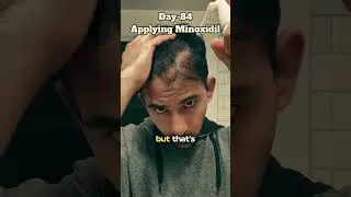 Day 84 of hair growth. 🥹