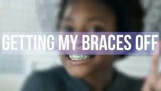 IM GETTING MY BRACES OFF!